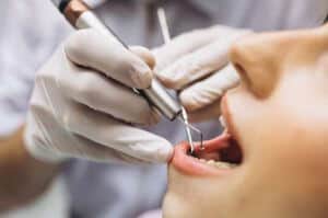טיפולי שיניים ברומניה מידע חשוב